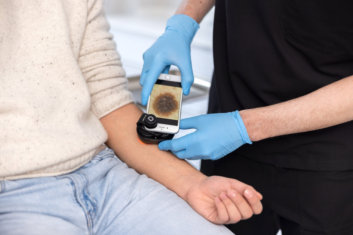 Cribado del cáncer de piel privado Fráncfort