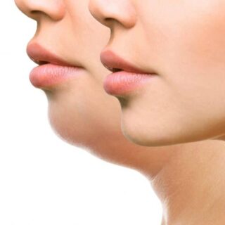 Lippen