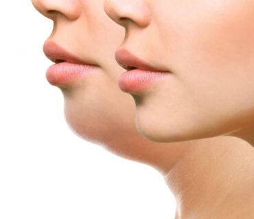 Lippen