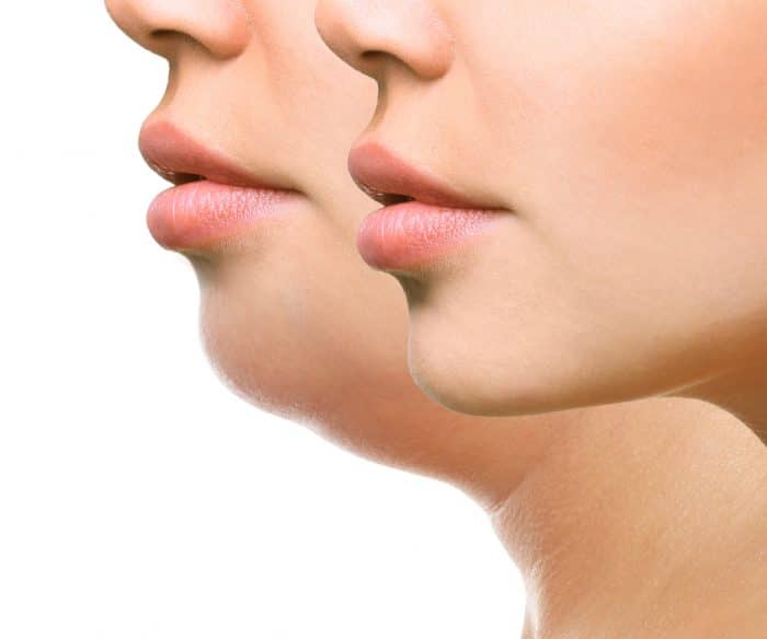 Lippen