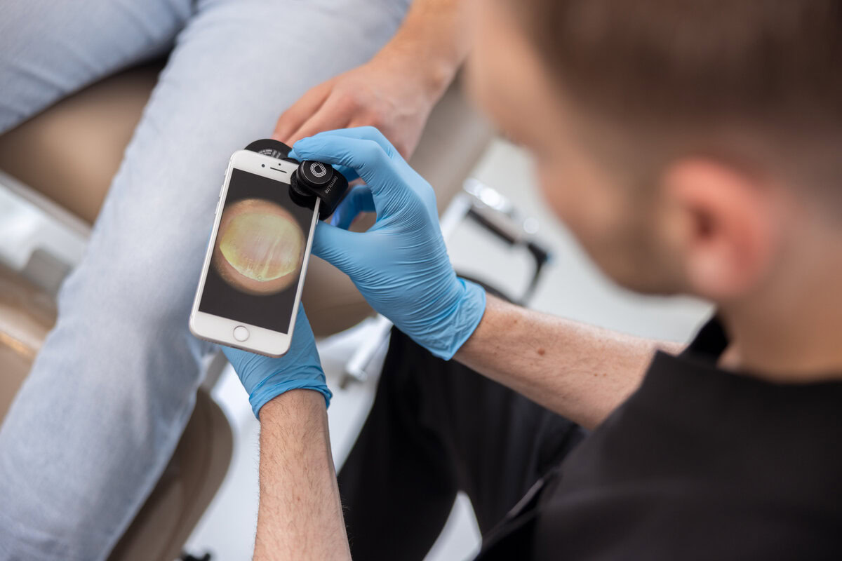 Лечение грибка ногтей Франкфуртский дерматолог